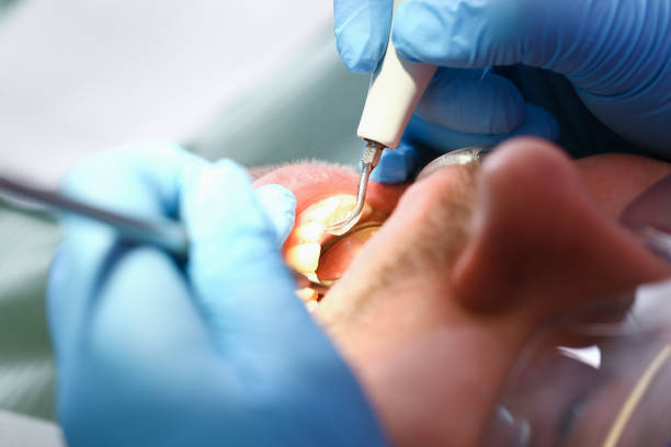 Best Urgent Dental Care for Toothache in Pennsboro, WV